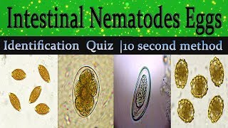 Intestinal Nematodes Eggs Identification Training Quiz with clear explanationDiagnostic features [upl. by Meyer]