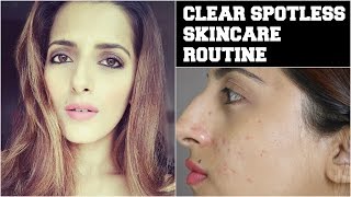 Beauty Tips For Face How To Get Crystal Clear Glowing Spotless Skin  Remove Acne amp Pimple Scars [upl. by Biddick]