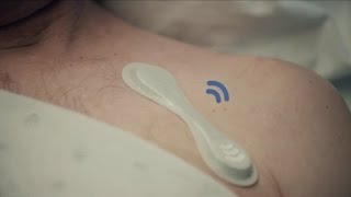 Keep a close watch on patients with the Philips wearable biosensor [upl. by Manas]