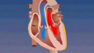 Transposition of the Great Arteries [upl. by Kayne]