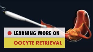 ✅ Oocyte Retrieval [upl. by Dedric]