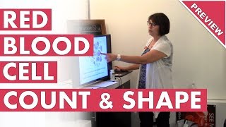 Low Red Blood Cell Count Causes How This Affects Your Mind Mood And Body Preview [upl. by Hairej]