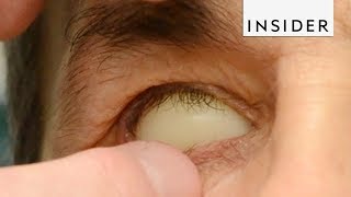 How Prosthetic Eyes Are Made [upl. by Flemings]