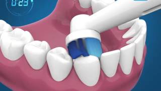 Como escovar os dentes com a escova de dentes elétrica [upl. by Eyram855]