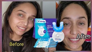 white bite pro teeth whitening kit for sensative teeth with LED light 35 carbamide peroxide [upl. by Lednem]