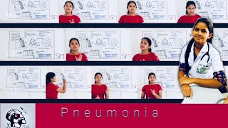 Pneumonia Clinical Presentation Sinhala [upl. by Delcina197]