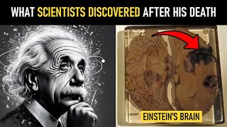 The Hidden Differences Between Einsteins Brain and a Normal Human Brain [upl. by Roht]