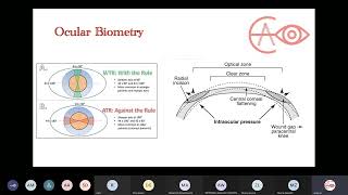 EA EYE investigations  Ocular Biometry [upl. by Mikah977]