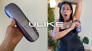 IPL Hair Removal Device on BrownDarker skin  ULIKE Air 10 [upl. by Itsyrk]