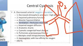 Medicine CYANOSIS Central Peripheral causes differential clubbing [upl. by Mandel221]