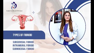 Fibroid Series Part 1  A Comprehensive Overview of Uterine Fibroid Types [upl. by Yrovi]