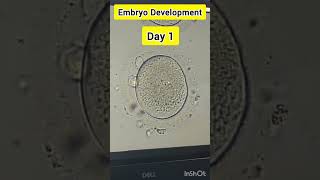 Embryo development process in IVF embryology embryodevelopment embryologist ivf ivfprocess [upl. by Zolner40]