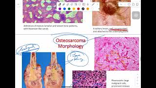 MSS pathology lab 2  part 2 [upl. by Arreip]