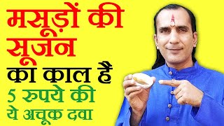 मसूड़ों में सूजन का इलाज Gum Swelling Treatment  masudo me sujan aur dard ka ilaj [upl. by Brookner36]