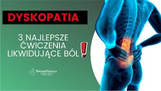 💥Dyskopatia  3 najlepsze ćwiczenia likwidujące ból💥 [upl. by Megan]