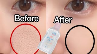 Johnsons baby oil for Natural Home Remedies for Open Pores  How to Get Rid of Open Pores on Face [upl. by Mallory]