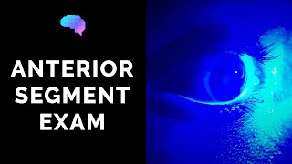 Anterior Segment Examination of the Eye  OSCE Guide  UKMLA  CPSA [upl. by Akisej]