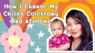 How To Change Colostomy Bag  Paano Mag Palit Ng Colostomy Bag [upl. by Bonilla]