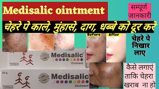 Medisalic ointment cream uses side effects [upl. by Kleeman]