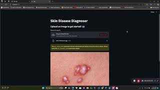 Skin Diseases Diagnoses AI [upl. by Grinnell]