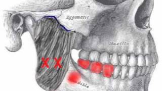 Masseter Muscle Assessment [upl. by Armin]