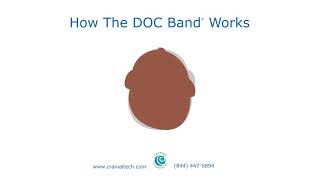 How The DOC Band® Works [upl. by Cordelia812]