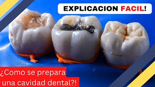 ¿Como se PREPARA una CAVIDAD DENTAL  Cavidad dental  Preparación de cavidades dentales [upl. by Natelson]