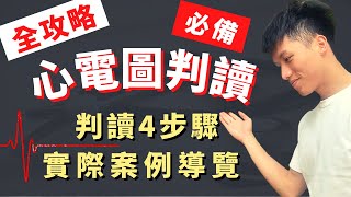 【4步驟搞定心電圖判讀】ECG EKG Reading實際案例導覽！ACLS、心律不整、心房顫動、心室顫動、房事阻斷、課後測驗！醫學生臨床值班必備技能！十二導程心電圖、心臟電氣生理、心臟傳導！ [upl. by Anirazc]