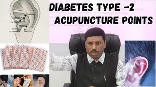 DIABETES TYPE 2 ACUPUNCTURE POINTS [upl. by Welch43]