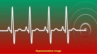 What is Telemetry Monitoring [upl. by Edwin63]