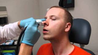 Septoplasty Nasal Splint Packing removal and nose cleaning [upl. by Etnomed]