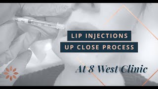 Lip Injections with Restylane Dermal Filler  8 West Clinic in Vancouver British Columbia [upl. by Ahseem769]