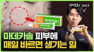 마데카솔 정말 피부 좋아지는 데 효과가 있을까ㅣ10년차 의사가 알려드립니다 마데카솔 케어 마데카솔 겔 마데카솔 분말 관리법의 효과가 궁금하시다면 이 영상을 꼭 확인하세요 [upl. by Warden]