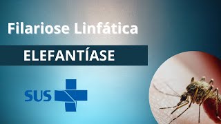 Filariose Linfática  elefantíase filaríase [upl. by Ycat27]