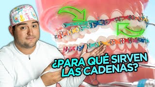 ¿PARA QUE SIRVEN LAS CADENAS ELÁSTICAS EN TUS BRACKETS ¿CUANDO SI Y CUANDO NO en tu ORTODONCIA [upl. by Adnwahsor483]