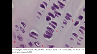925  ATTO  Ossificação endocondral [upl. by Osnofedli]