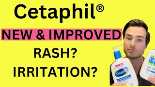 Cetaphil Rash Ingredients Triggering Skin Nightmares [upl. by Conard211]