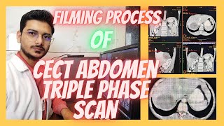 CT SCAN Abdomen Triple phase Filming process Triphasic abdominal Filming radiologytechnologist [upl. by Enihpets]