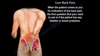 mechanical low back pain icd 10 [upl. by Ibmat]