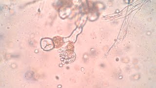 Sporangium of Pythium and Allomyces [upl. by Joung]