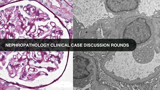 20240220 Nephropathology Clinical Case Discussion Rounds [upl. by Snapp]