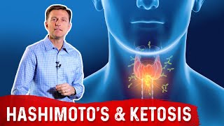 Hashimotos Disease Hypothyroid and Keto Ketogenic Diet – Dr Berg [upl. by Elokkin]