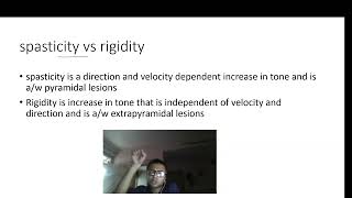 spasticity vs rigidity [upl. by Aradnahc]