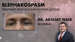 Understanding Blepharospasm Treatment  Botulinum Toxins Dr Akshay Nair Mumbai [upl. by Anined]