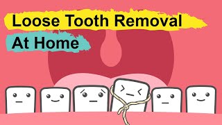 Wisdom tooth removal in 5 MIN or less Surgical Guide Online Course  Free eBook [upl. by Nitsej]