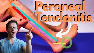 Peroneal Tendonitis Treatment 2024 Peroneus Brevis amp Longus Pain [upl. by Yerdua]