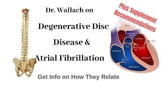 Dr Wallach on Degenerative Disc Disease amp Atrial Fibrillation [upl. by Nithsa]