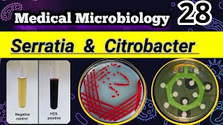 Serratia amp Citrobacter Late lactose Coliforms شرح بالعربي [upl. by Bruner]