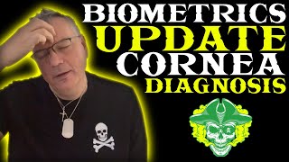 Biometrics Update amp Cornea Diagnosis [upl. by Tut705]