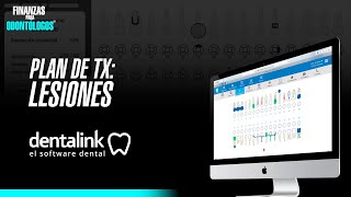 Plan de Tratamiento Lesiones en Dentalink Plan Basic Finanzas Para Odontólogos [upl. by Tupler]